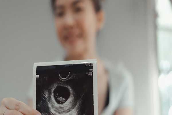 پزشک زنان در هفته ششم بارداری