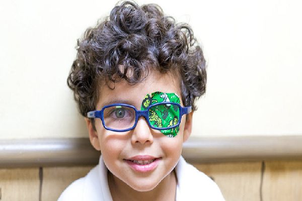 درمان انحراف چشم در کودکان