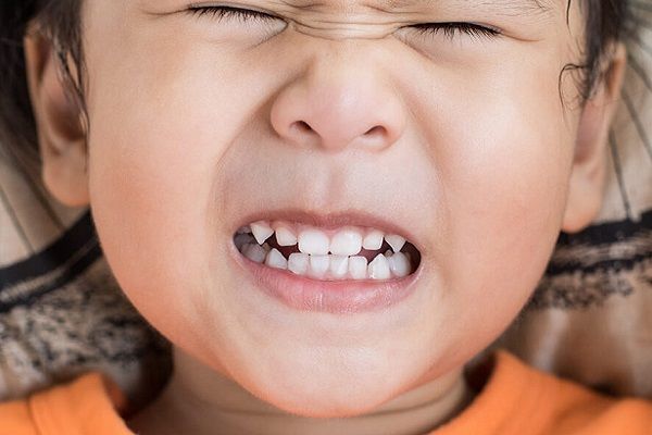 علت دندان‌قروچه در خواب چیست