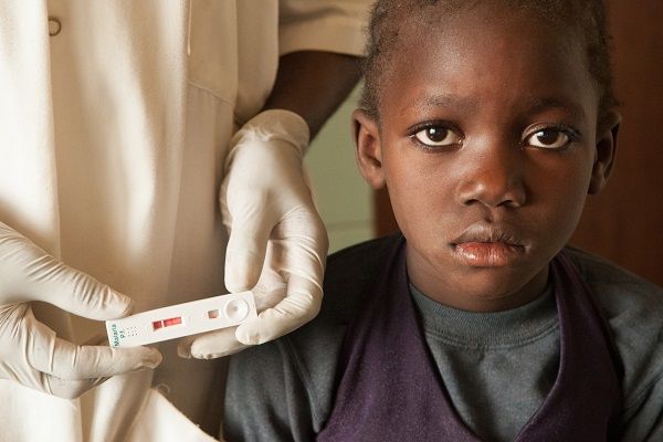 کودکان مبتلا به اچ آی وی و ایدز چه علائمی را نشان می‌دهند؟