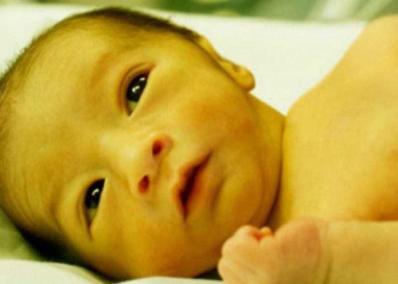 درمان زردی نوزاد با لیموشیرین چگونه است؟