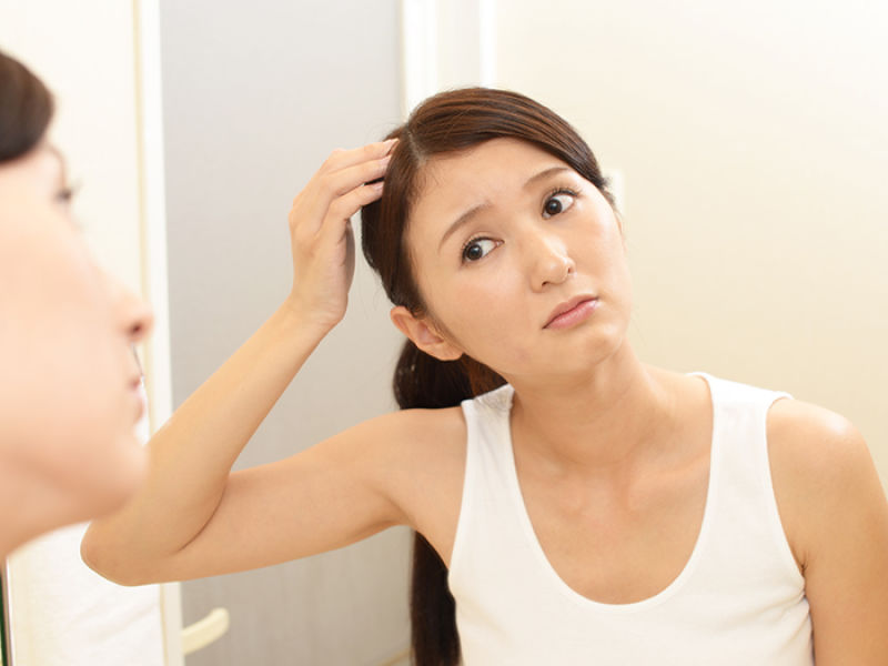 ریزش موی هورمونی چیست