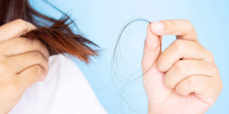 ریزش موی هورمونی چیست و چرا رخ می دهد
