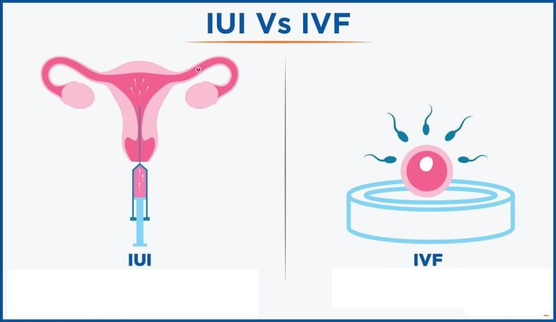 فرق IVF و IUI