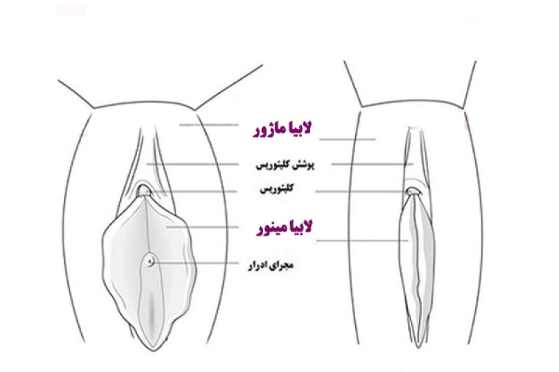 علت تغییر شکل لبه واژن