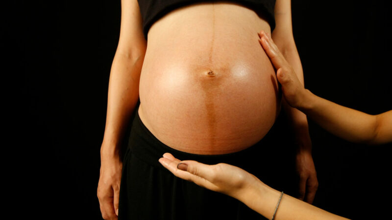 تغییرات ناف در بارداری