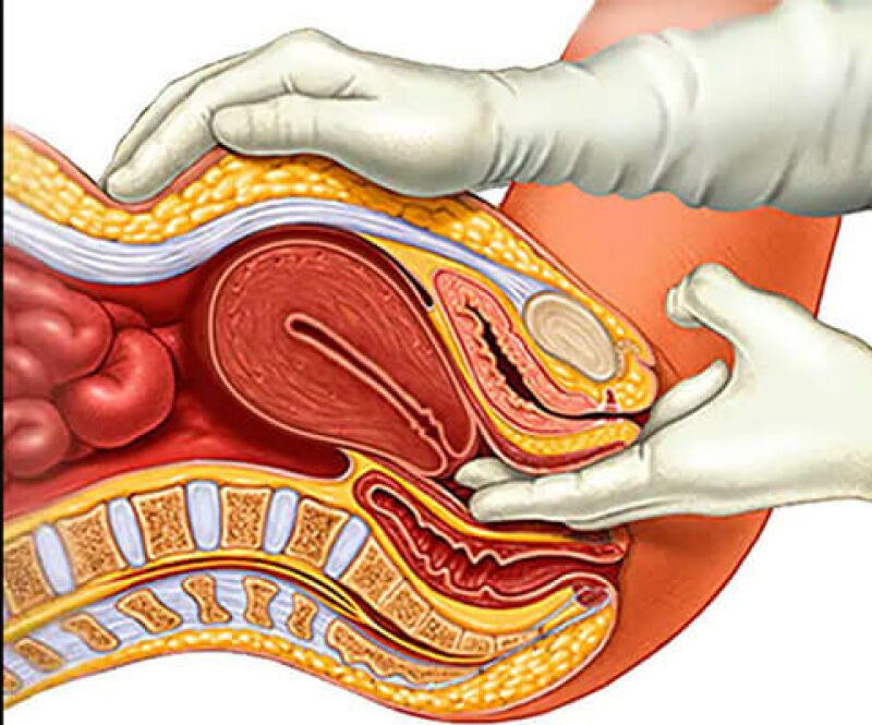 تصویر معاینه لگن در بارداری