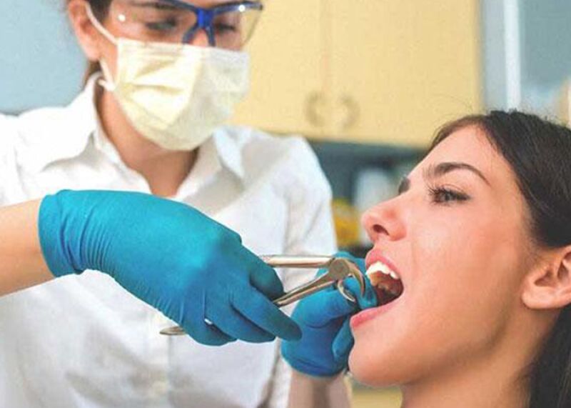 عوارض کشیدن دندان در بارداری