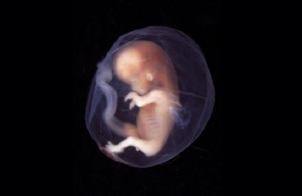 بیماری‌های جنین در بارداری