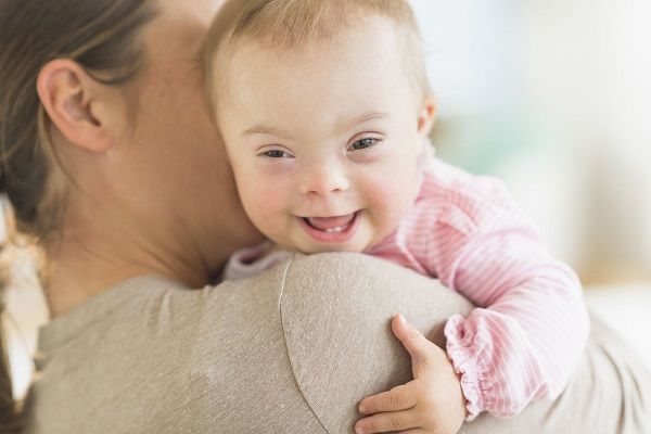 چطور به کودکی با سندرم داون شیر بدهید