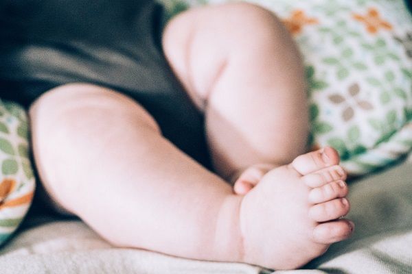 انحراف انگشتان پا به داخل یا درون گردی انگشتان پا به داخل در کودک