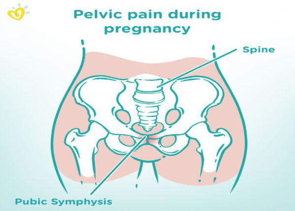 درد استخوان عانه در بارداری