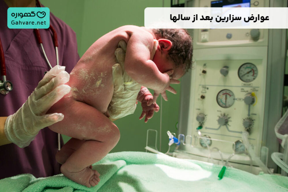 عوارض سزارین