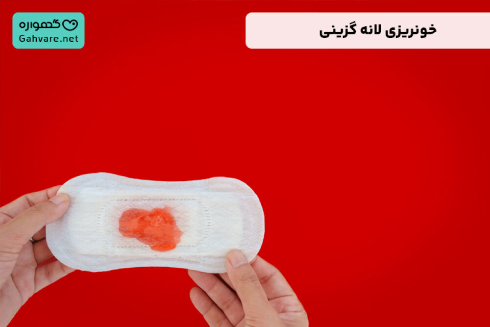 خونریزی لانه گزینی