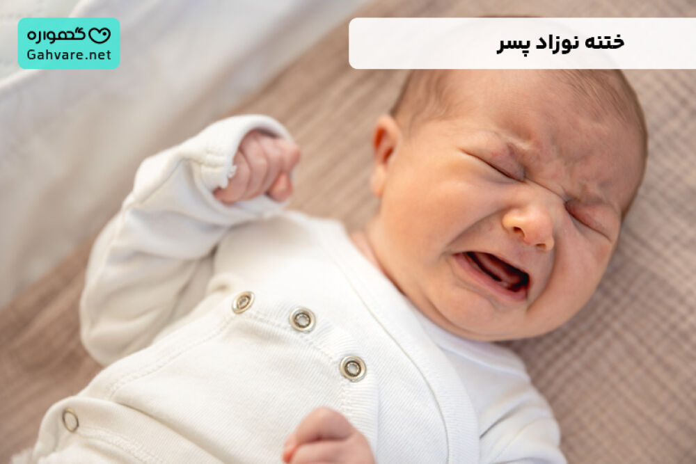 ختنه نوزاد پسر | عکس، مراقبت و انواع روش ختنه کردن نوزاد