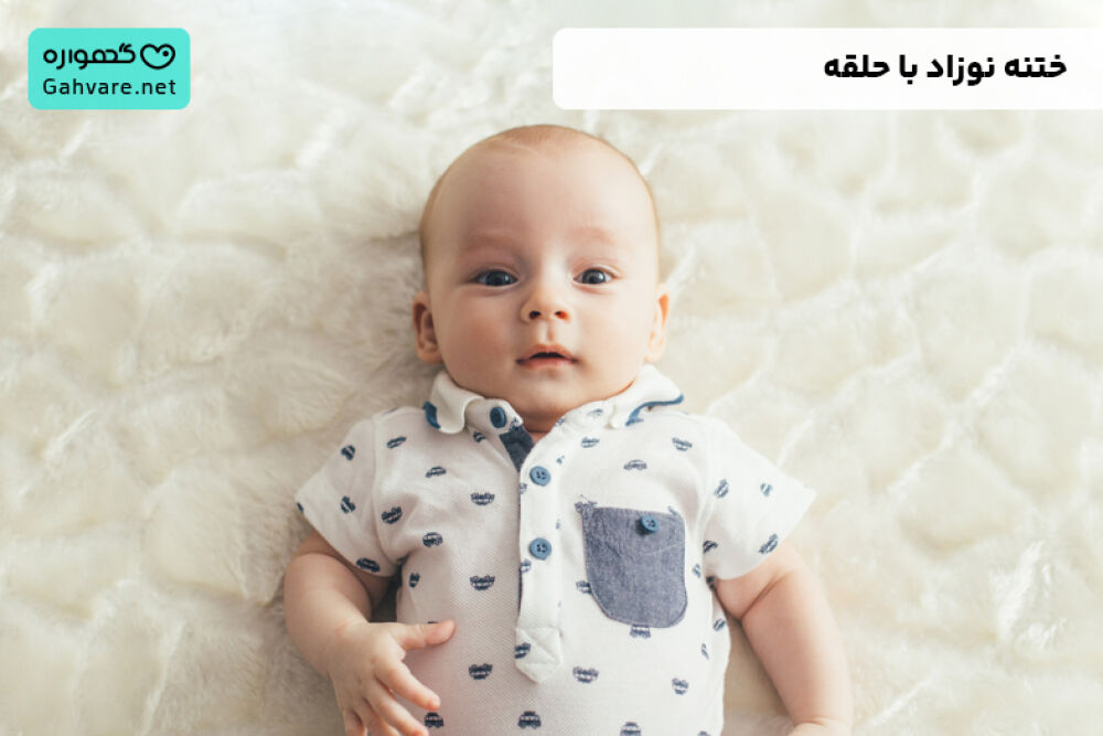 ختنه کردن نوزاد با حلقه | مراقبت های بعد از ختنه با حلقه مراحل افتادن آن