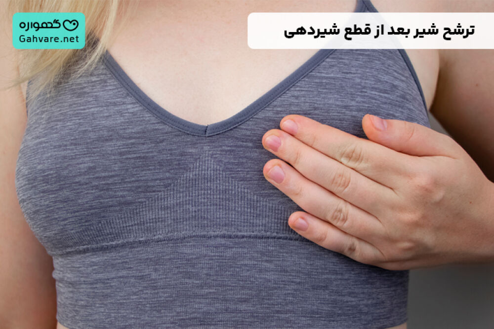 ترشح شیر بعد از قطع شیردهی