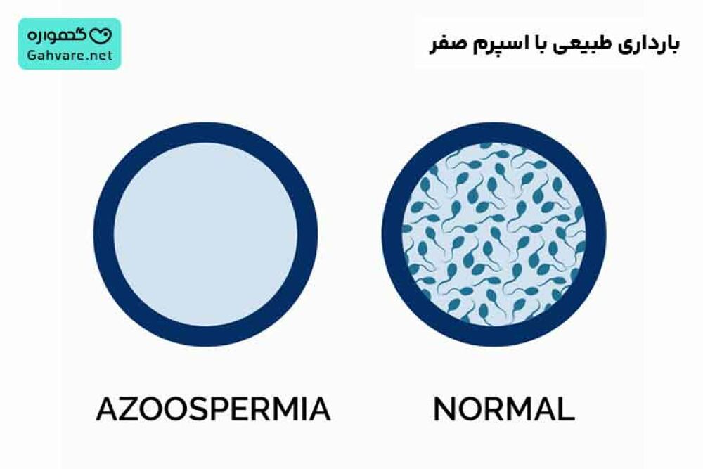بارداری طبیعی با اسپرم صفر