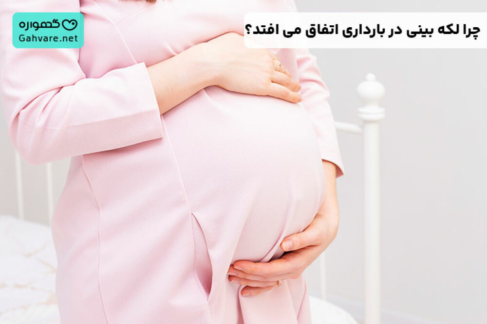 لکه ‌بینی در بارداری