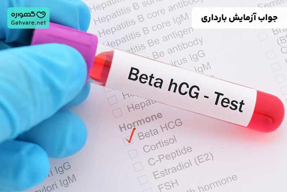چگونه جواب آزمایش بارداری را بخوانیم
