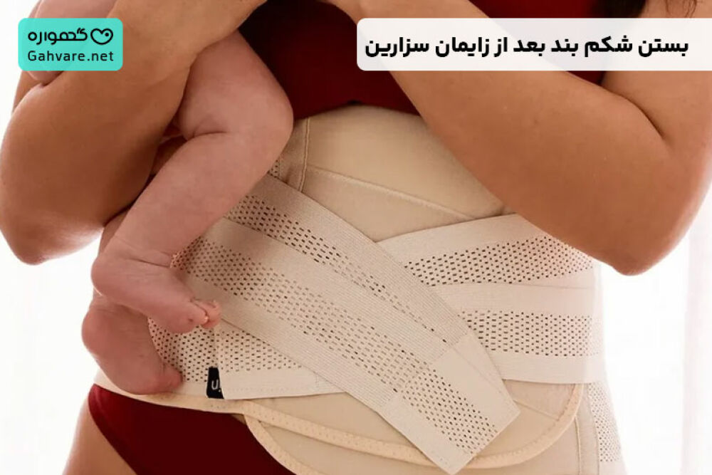 بستن شکم بعد از سزارین