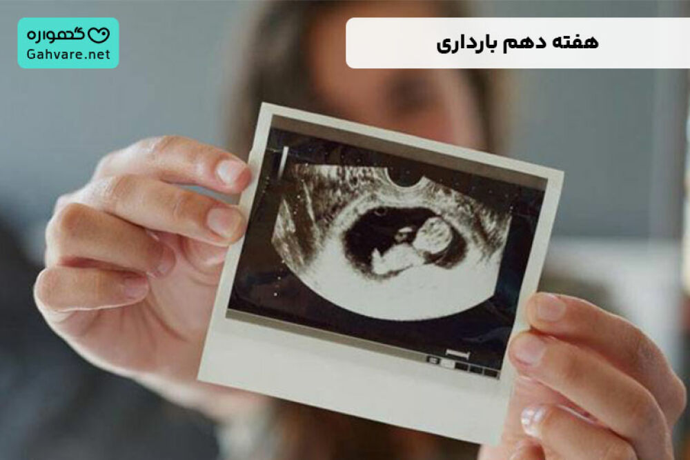 هفته دهم بارداری