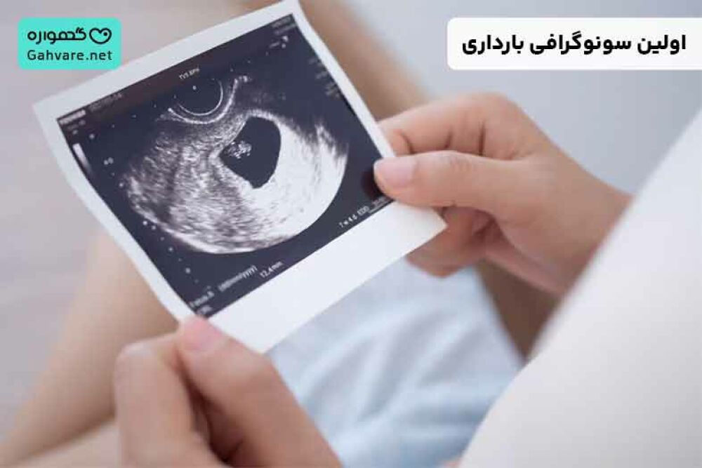 اولین سونوگرافی بارداری