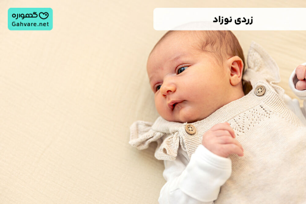 زردی نوزاد چیست