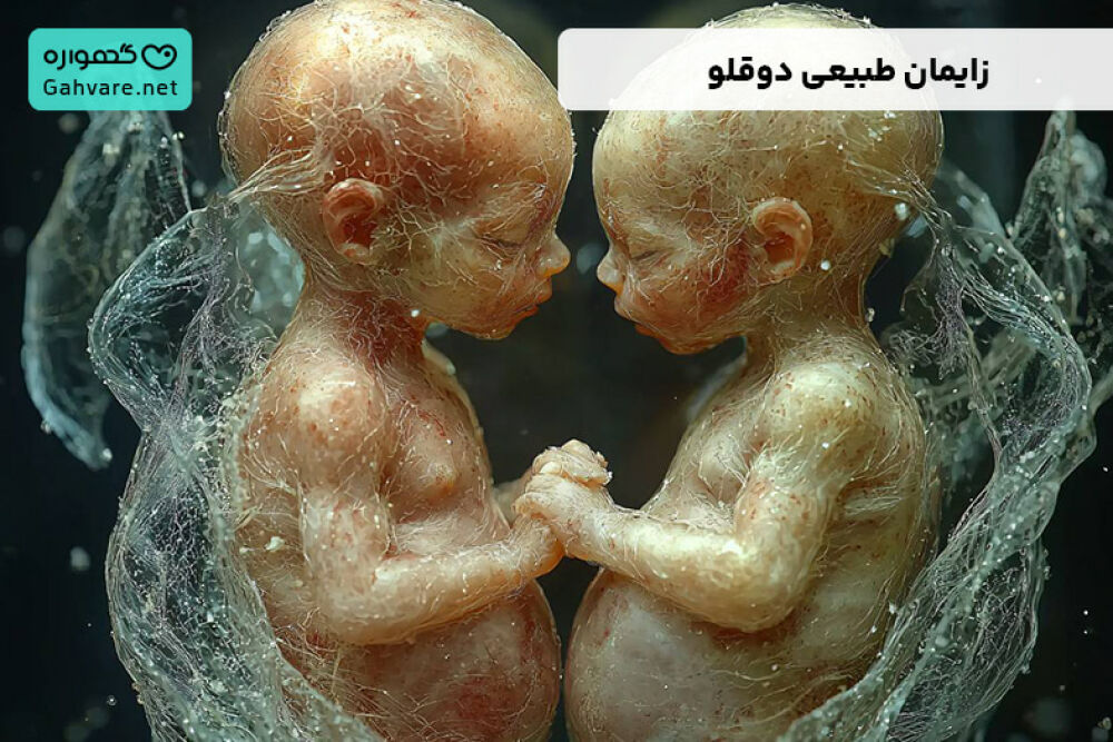 چندقلوها با روش زایمان طبیعی