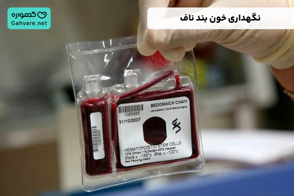 نگهداری خون بند ناف