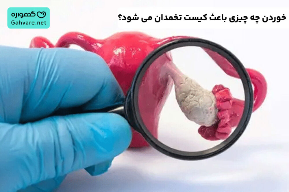 غذاهای مضر برای کیست تخمدان چیست؟