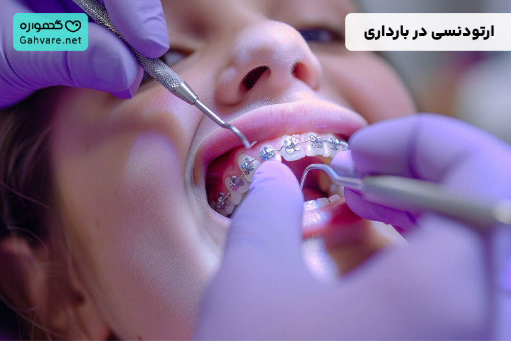 ارتودنسی در بارداری