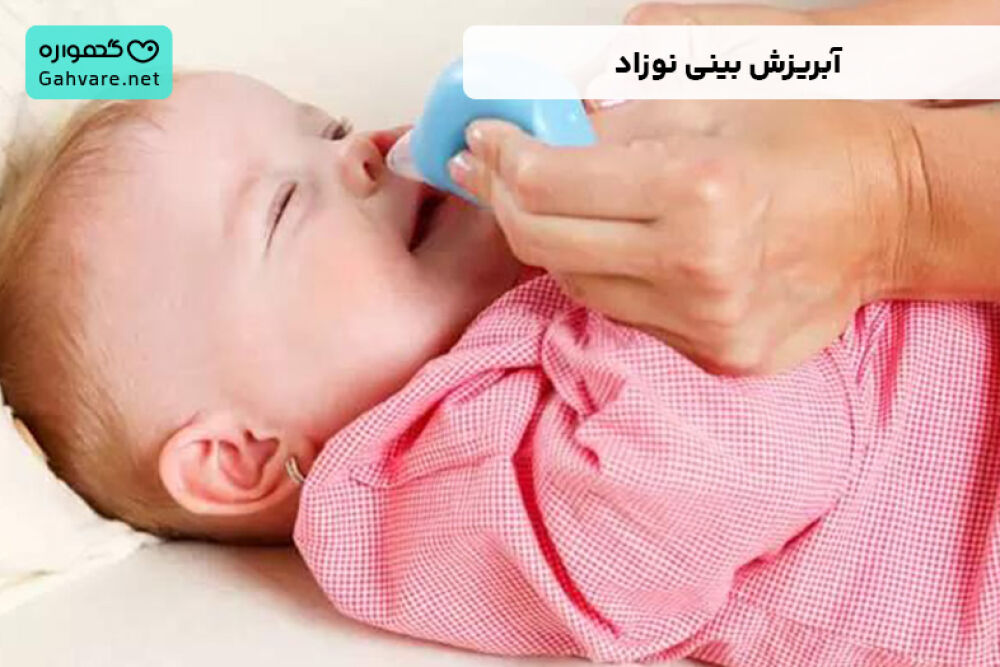 آبریزش بینی نوزاد