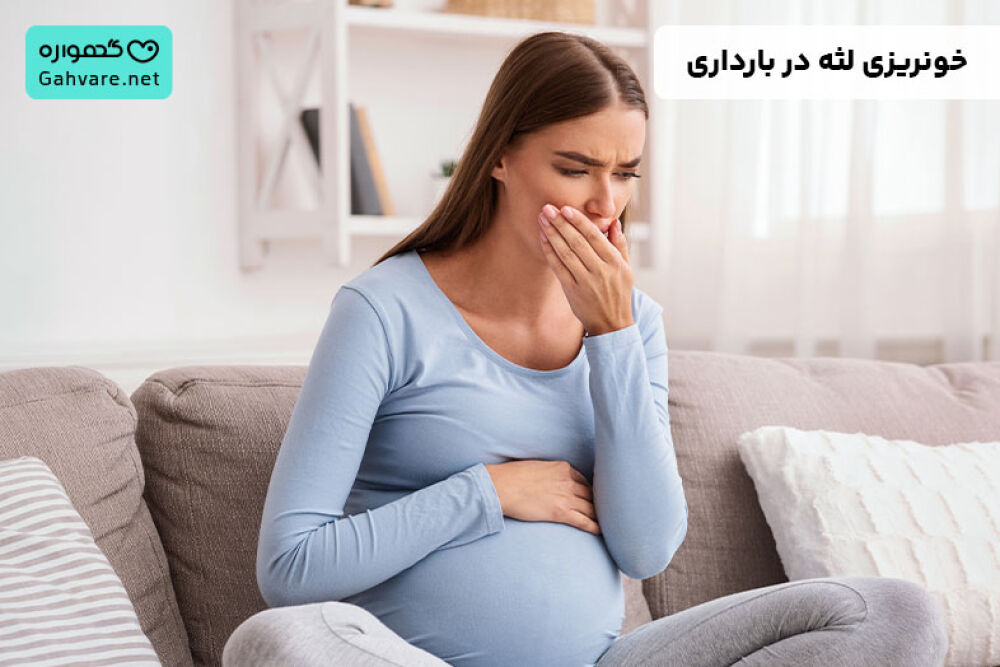 خونریزی لثه در بارداری