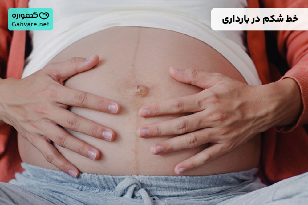 خط شکم در بارداری