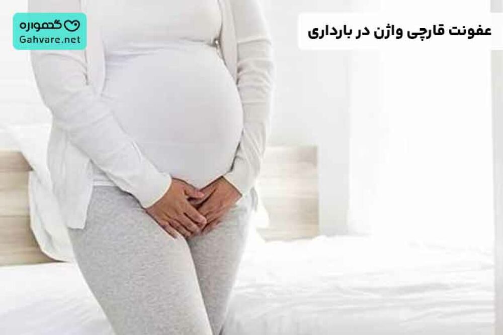 عفونت قارچی واژن در بارداری