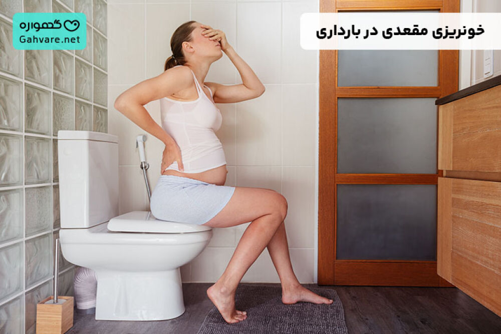 بواسیر و خونریزی مقعد در بارداری