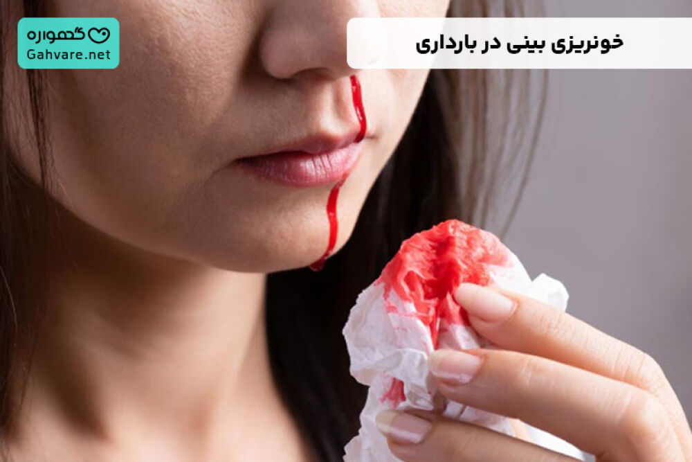 خونریزی بینی در بارداری