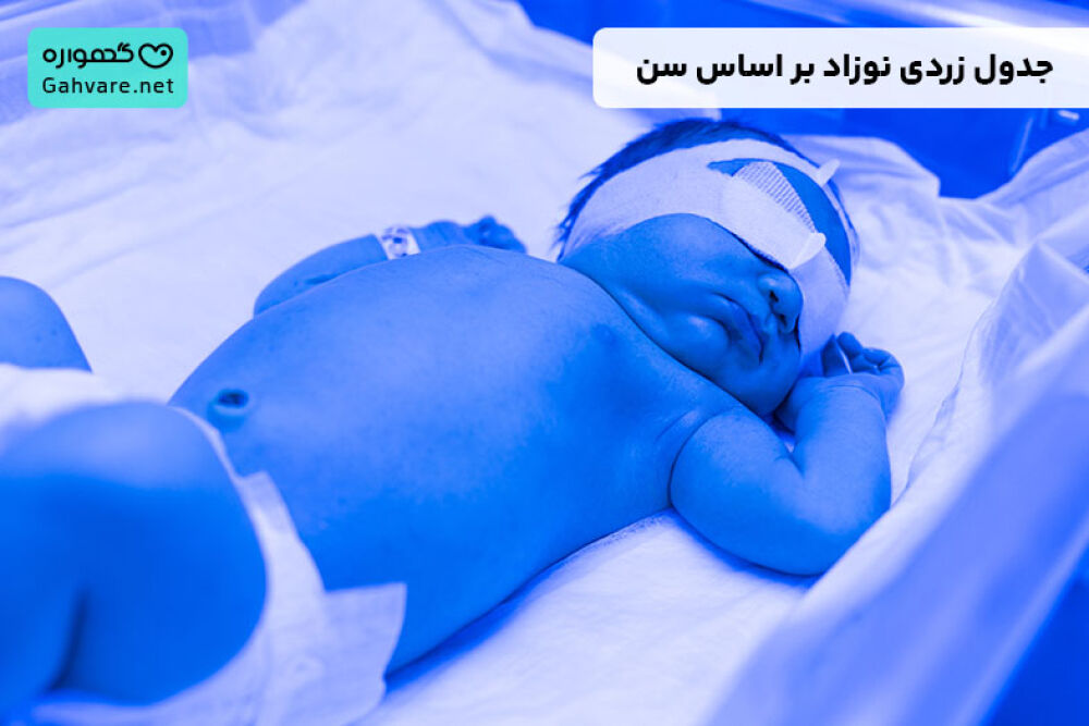 جدول زردی نوزاد
