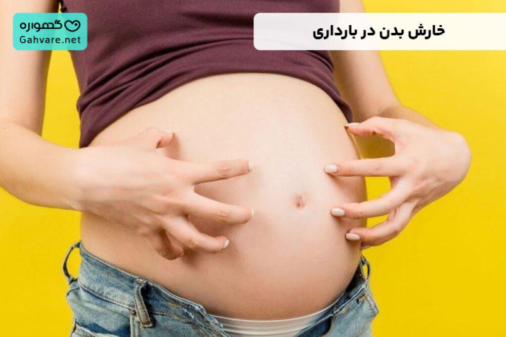 درمان خانگی خارش بدن در بارداری