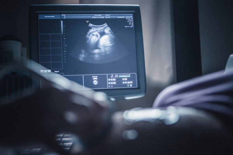 زمان دیده شدن جنین در سونوگرافی واژینال