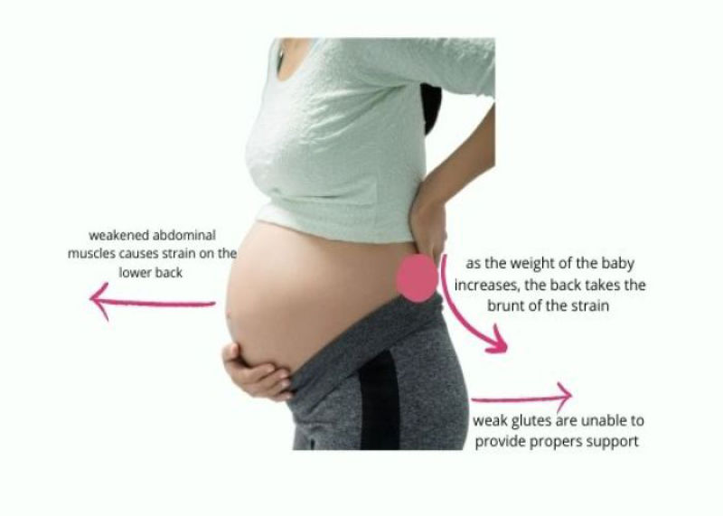 وضع حمل و زایمان با درد استخوان عانه در بارداری