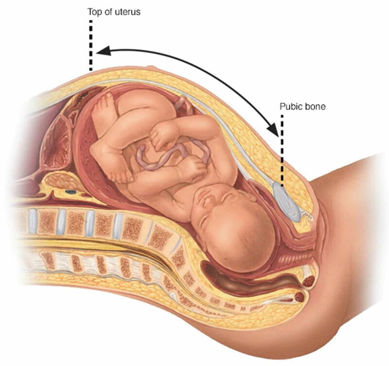 آیا قد جنین در سونوگرافی دقیقا مشخص می‌شود؟