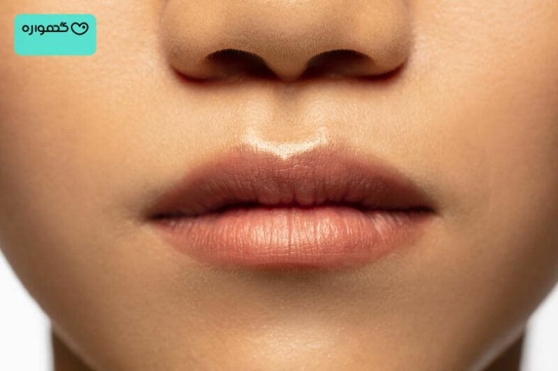 لب های پرتر و تیره تر در بارداری