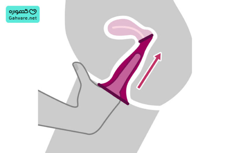 گذاشتن کاندوم زنانه داخل واژن