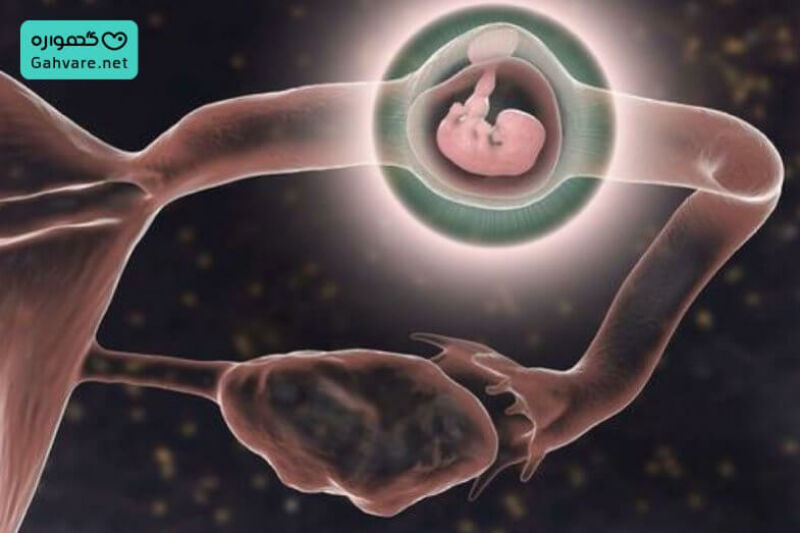 عدد بتا در بارداری خارج از رحم