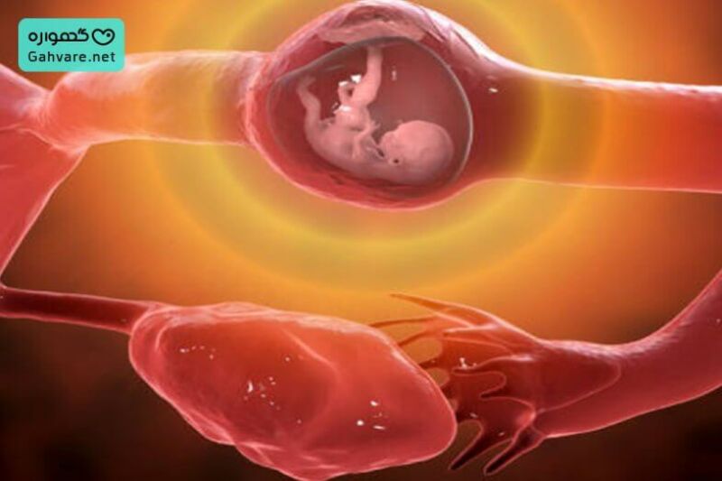 عدد تیتر بتا در بارداری خارج از رحم