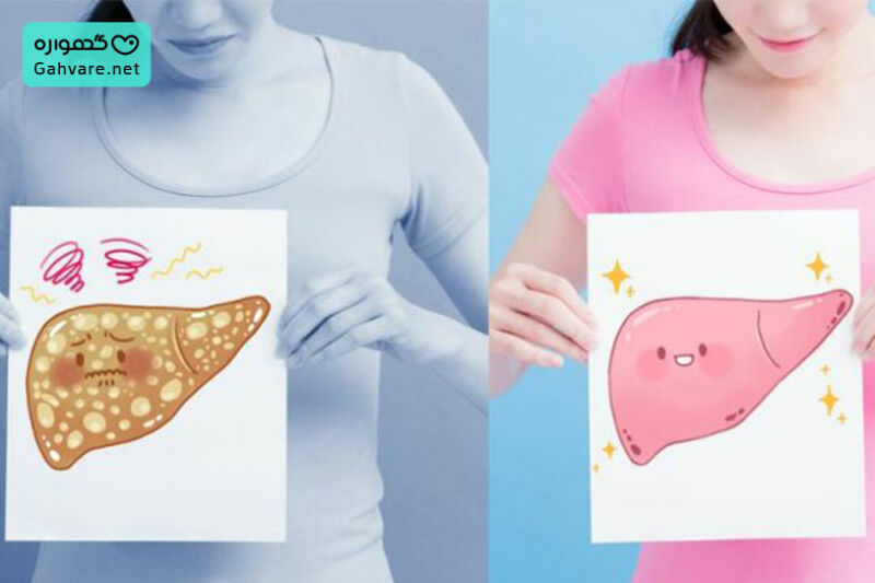 بارداری با کبد چرب