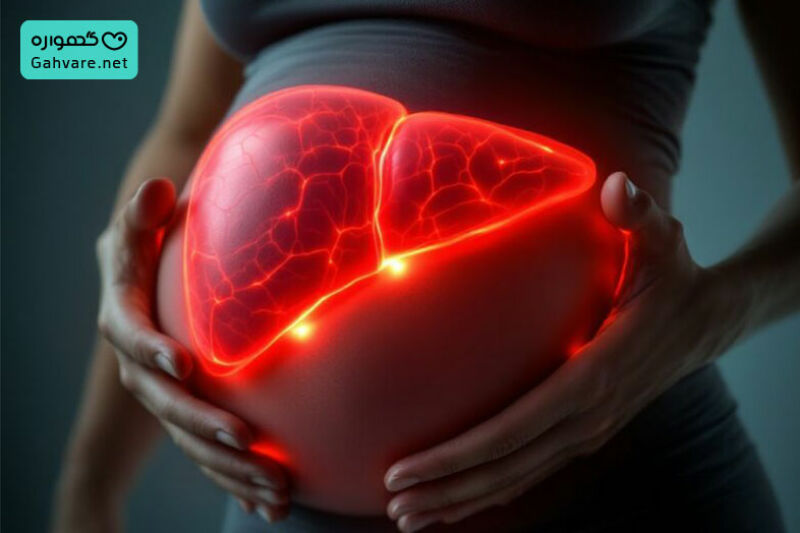 کبد چرب بارداری