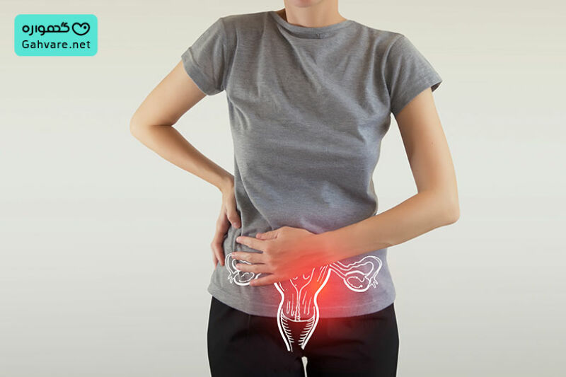 چه کسانی در معرض خطر بارداری خارج از رحم هستند؟